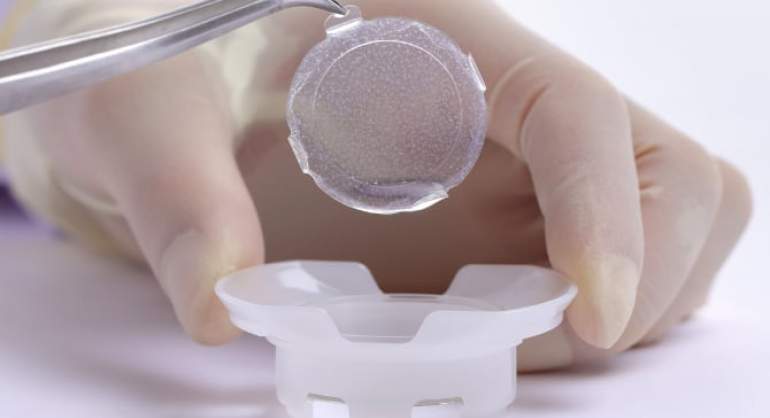 В Японии одобрен новый метод лечения лимбальной недостаточности посредством трансплантации аутологичного культивированного эпителия слизистой оболочки рта 